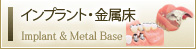 インプラント・金属床 Implant & Metal Base